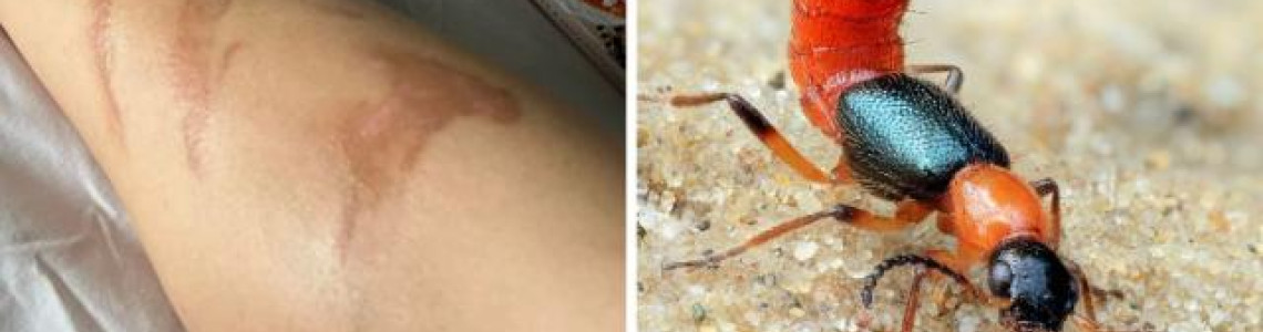 Rove Beetles Beware: Effective Ways to Protect Your Home from These Toxic Pests Rove Beetles Beware: Effective Ways to Protect Your Home from These Toxic Pests